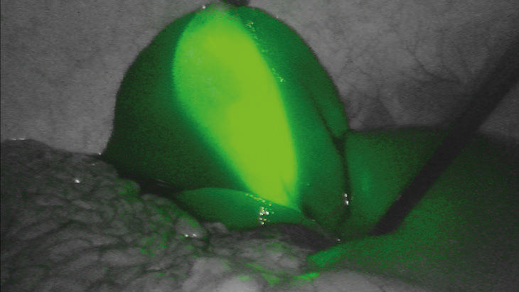 Zielony FI - technologia obrazowania fluorescencyjnego 3D