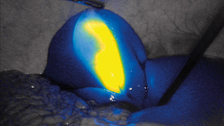 Intensywność FI - technologia obrazowania fluorescencyjnego 3D