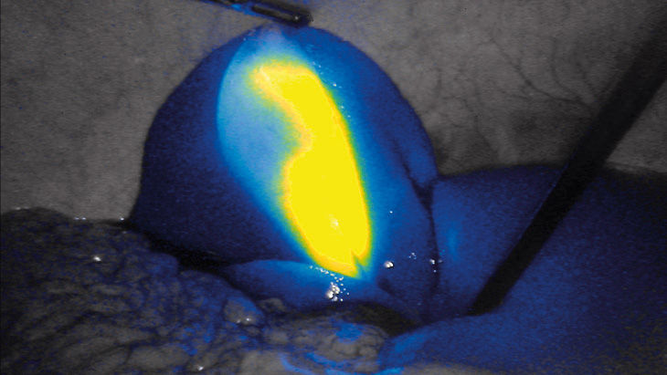 Intensywność FI - technologia obrazowania fluorescencyjnego 3D