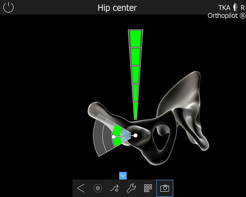 Zrzut ekranu oprogramowania OrthoPilot® TKA - Hip center