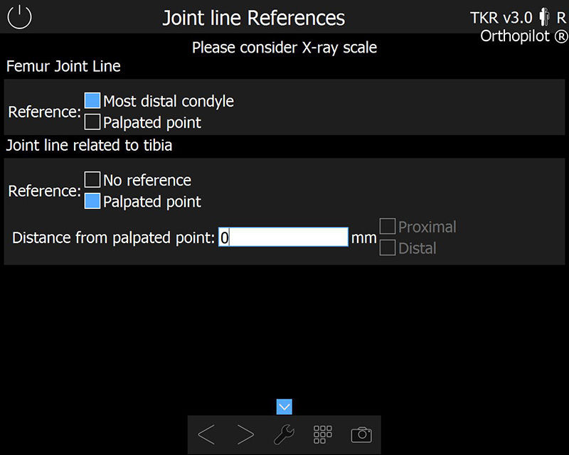 Zrzut ekranu oprogramowania OrthoPilot® TKR - odniesienia do wspólnej linii