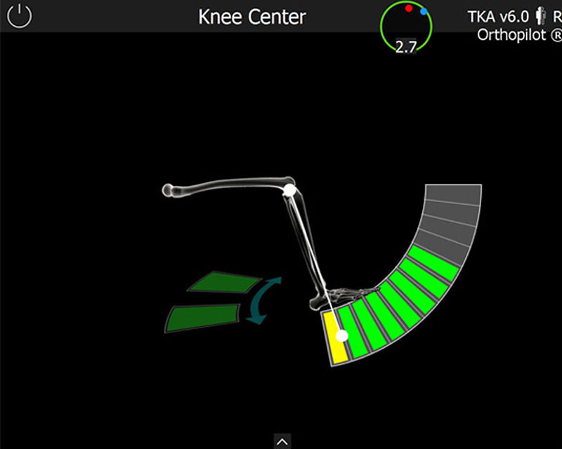 Zrzut ekranu oprogramowania OrthoPilot® TKA - ośrodek kolana