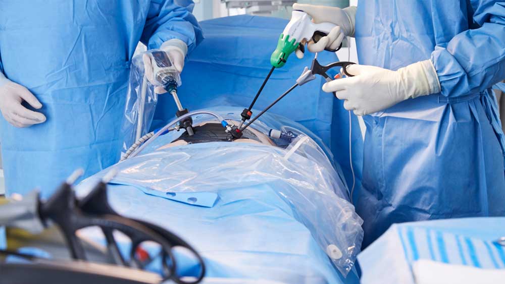 Zbliżenie na sytuację w chirurgii małoinwazyjnej z AESCULAP Caiman