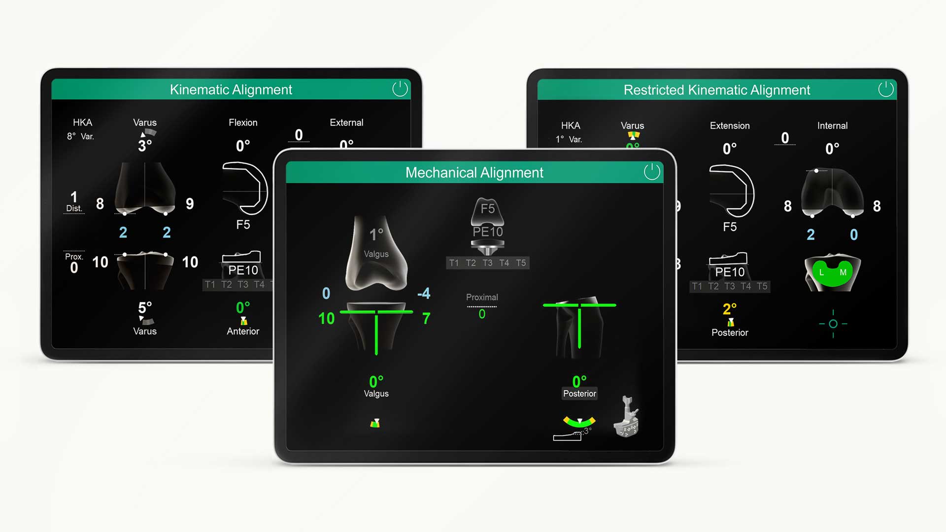 Trzy różne ekrany OrthoPilot Elite pokazujące różne typy oprogramowania: ustawienie mechaniczne, ustawienie kinematyczne i ustawienie kinematyczne z ograniczeniami.