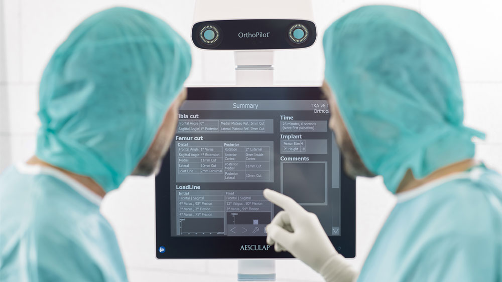 Dwóch lekarzy w fartuchach i rękawicach patrzy na urządzenie orthopilot elite, lekarz wskazuje na ekran.
