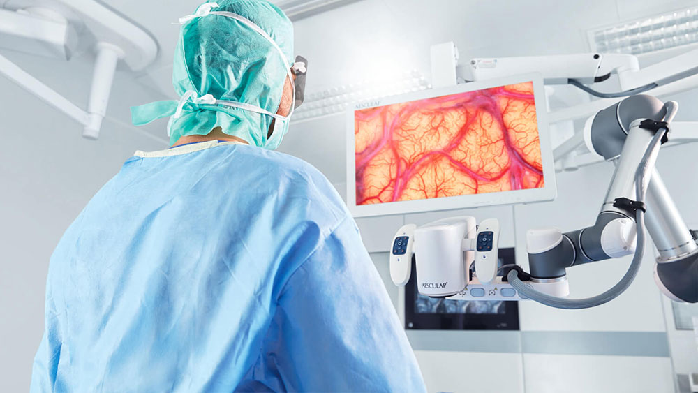 Chirurg wykonujący zabieg z użyciem systemu Aesculap Aeos® patrzy na monitor. 